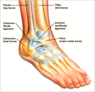 heel pain after ankle sprain