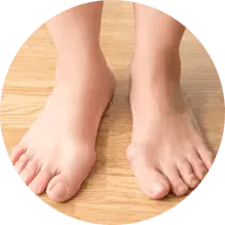 Bunions/Hammertoes Removal, Surgery and Alternatives, Treatment and Recovery Issaquah, WA 98027