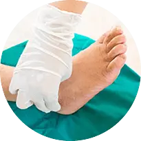Peripheral neuropathy in the foot - treatment and care in Issaquah, WA 98027