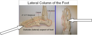 Lateral Column with arrows resized 600